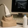 Échographie de la thyroïde : comprendre vos résultats et leur impact sur le poids